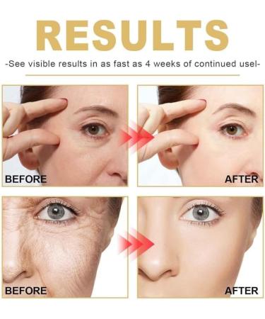  1/2/3Pcs Young Golden Refining Serum Hydrating Glowing Facial Serum for Senior Age Women Advanced Collagens AntiAgeing Serum Firms Skin for All Skin Types 30ml/1fl.oz (3Count (Pack of 3)) - Buy Online on GoSupps.com