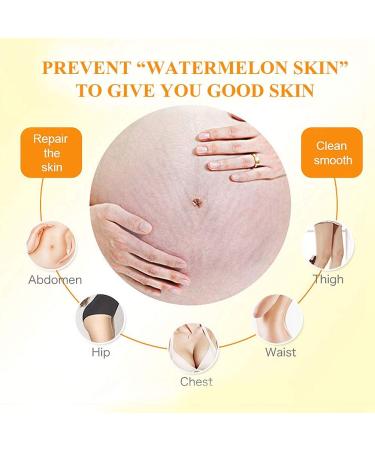 Stretch Strip Scar Cream | Anti-Strain Body Repair | Powerful Pregnancy Scar Removal - Buy Online on GoSupps.com