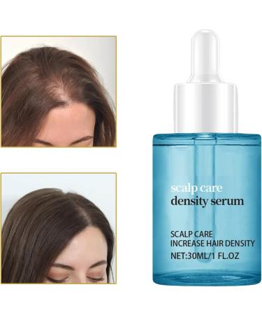 Frizz-Free Hair Oil - 30ml Natural Density Liquid - Scalp and Hair Oil to Moisturize Restore Prevent Breakage Loss and Thinning Adding Volume and Thickness - Buy Online on GoSupps.com