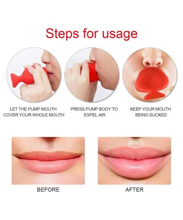 Buy Women s Fish Shape Lip Plumper Beauty Tool - Enhance Your Lips | International Shipping Available - Buy Online on GoSupps.com
