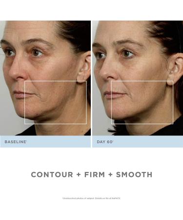 Nuface Trinity Starter Kit - Ultimate Facial Toning Device for Radiant Skin | Fast International Shipping - Buy Online on GoSupps.com