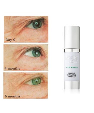 Shop Repechage Vita Cura Triple Firming Cream - Anti-Aging Face & Neck Moisturizer | Improve Skin Firmness & Reduce Wrinkles - 1fl oz/30ml - Buy Online on GoSupps.com