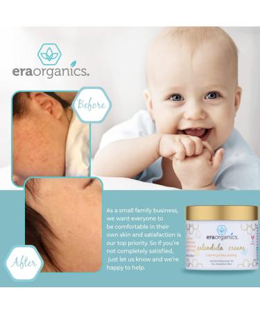 Organic Calendula Cream for Babies | Soothing Baby Lotion for Sensitive Skin, Eczema, Cradle Cap, Acne | With Cocoa Butter, Rosemary, Zinc Oxide - Buy Online on GoSupps.com