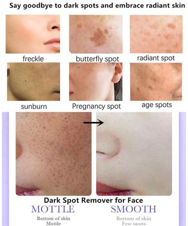 Go Ho Dark Spots Corrector - Vitamin C & B5 Skin Whitening Cream for Body & Intimate Areas Dark Spot Remover for Face - 1.7oz - Buy Online on GoSupps.com