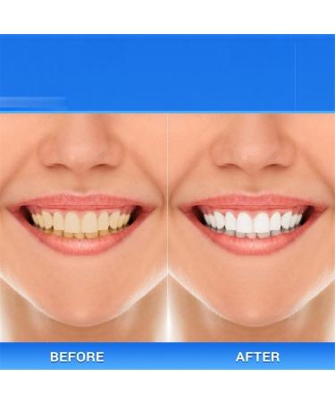 Xoermioy Niacinamide Whitening Toothpaste - Brightening & Deep Clean Kit (2PCS) for Dazzling White Smile | International Shipping - Buy Online on GoSupps.com