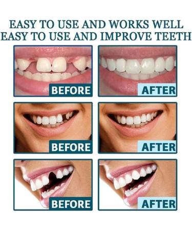 2 Pairs Regain Confidence Smile for Women and Men Temporarily Adjustable - Buy Online on GoSupps.com