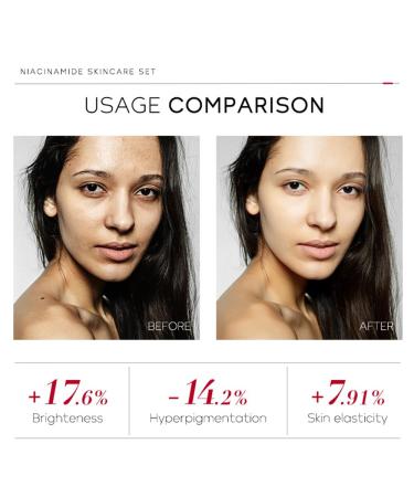 Niacinamide Skincare Set - Hydrate & Even Skin Tone | Travel-Friendly 4pcs Kit for Women Moms & Teens - Perfect Birthday Gift - Buy Online on GoSupps.com