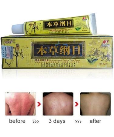 Biaoyun 10pcs Dermatitis & Rash Relief Cream Set - Soothes Itching & Inflammation, External Use - Buy Online on GoSupps.com