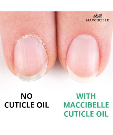 Maccibelle Pomegranate & Fig Cuticle Oil 0.5 oz - Hydrates and Heals Dry, Cracked Cuticles - Buy Online on GoSupps.com