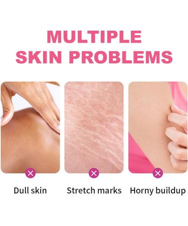  MagiSel Body Peeling Oil Exfoliating Oil 110ml Scrub for Dark Spots Whiten & Soften Callus Removal Brightening Skin Tone - Buy Online on GoSupps.com