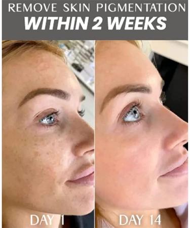 DUBUSH Whitening Serum Capsules Dark Spot Corrector Daily Face Serum Capsules Facial Lightening Cream AntiAging AntiWrinkle Whitening Serum - Buy Online on GoSupps.com