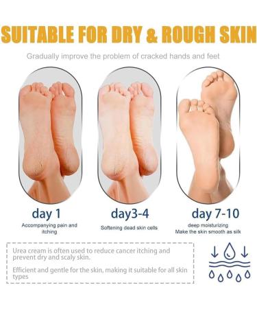 YOKIKIYO Moisturizing and anti-cracking foot cream exfoliating for the skin 60% urea plus 2% salicylic acid for dry cracked heels and feet - Buy Online on GoSupps.com
