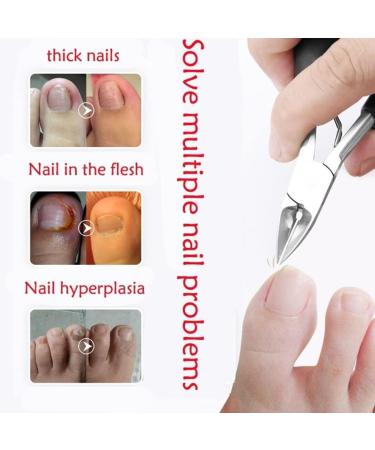 Precision Toenail Clippers Set for Thick or Ingrown Toenails Durable Stainless Steel Nail Care Tools Nail Clippers - Buy Online on GoSupps.com