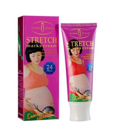 AICHUN BEAUTY Stretch Marks Cream Snail Extract Reduce Skin Scars Remove Damaged Skin Cells 120g/4.23oz