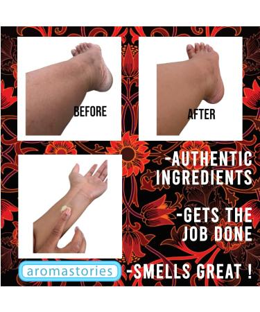 Buy Patchouli Musk Body Butter 4oz | Luxurious & Sensual Skin Salve with Essential Oils | Moisturizer with Shea Olive Oil & Beeswax - International Shipping Available - Buy Online on GoSupps.com