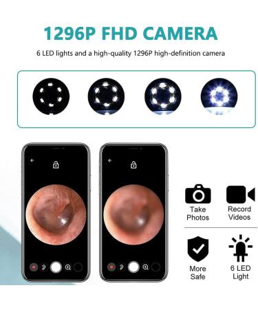 High-Definition Ear Wax Removal Tool with Otoscope & LED Lights - 4 Spoons Compatible with iOS & Android - Buy Online on GoSupps.com