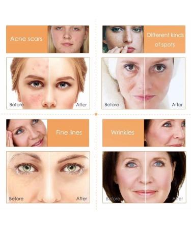 Organic Vitamin C Serum for Face - Anti Aging Brightening Serum with Hyaluronic Acid for Dark Spot Correction, Fine Lines & Wrinkles - Anti Wrinkle, Dark Circles, Age Spots, Pore Cleanser, Acne Scars - Buy Online on GoSupps.com