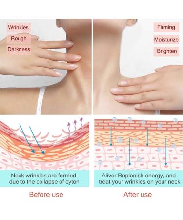 Buy TUBALU Neck Firming Cream - Anti-Aging Moisturizing Neck Lifting Cream with Roller Massage for Smooth Skin & Wrinkle Reduction - Ships Worldwide - Buy Online on GoSupps.com