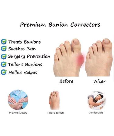 Fohapfam Women Big Toe Correction Sandal with Arch Support, Orthopedic Bunion Corrector & Toe Straighten Shoes - Black 6.5 - Buy Online on GoSupps.com