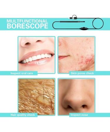 Marycan Ear Wax Remover HD View Otoscope with Light - 6 Adjustable LED Lights for Adults, Kids & Pets - Buy Online on GoSupps.com