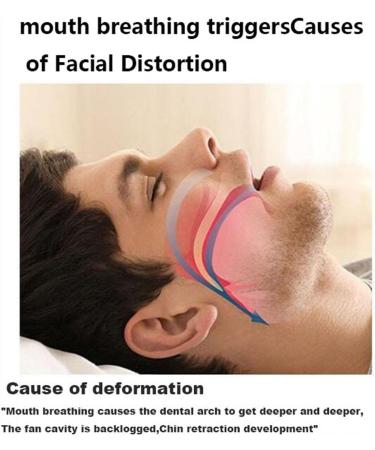 PPE Home Anti-Snoring Chin Strap | Sleep Shut-Up Mouth Breathing Corrector | Snoring Solution for Men and Women | Pink 1 - Buy Online on GoSupps.com