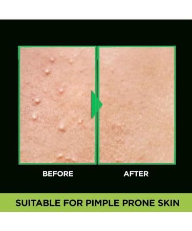 Men's Acne Fight Anti-Pimple Face Wash with Salicylic Acid | Herbal Repair | All Skin Types | 100g (3.38 Fl oz) - Buy Online - Buy Online on GoSupps.com
