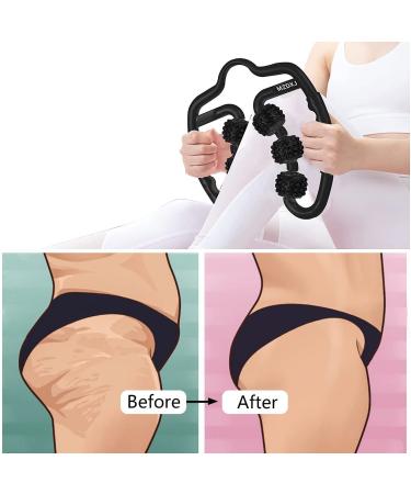 Six-Wheel Fascia Muscle Roller | Cellulite Massage Roller for Muscle Soreness Relief | Thigh, Calf, Arm, Shoulder | Deep Tissue Massage Roller - Black - Buy Online on GoSupps.com