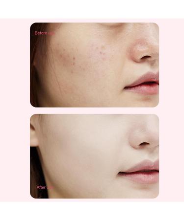 Exfoliating Facial Scrubber Facial Scrubber - Vibrating Facial Brush Shape Facial Brushes for Skin Care for Women and Men Waterproof Electric Brush Pink - Buy Online on GoSupps.com