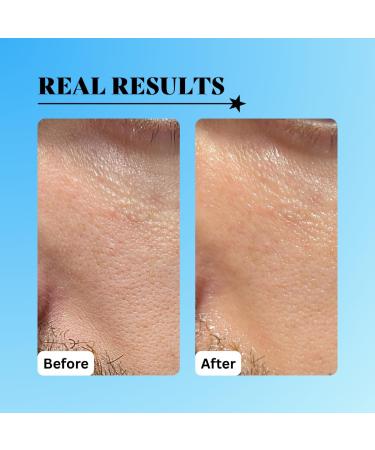 Radical Replenishment Hydration Serum with Hyaluronic Acid Glycerin Cucumber Extract 1oz All Skin Types Anti-Aging Peppermint & Spearmint Scent - Buy Online on GoSupps.com