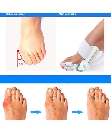 Orthopedic Bale Toe Corrector for Men & Women | Adjustable Smooth Rail with Silicone Pads for Pain Relief - Buy Online on GoSupps.com