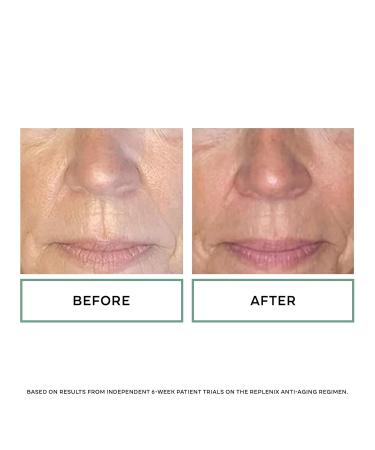 Replenix Glycolic Acid Resurfacing Cream Hydrating & Lightweight Medical-Grade Exfoliating Face Moisturizer for Skin Discoloration (0.5 fl oz) - Buy Online on GoSupps.com