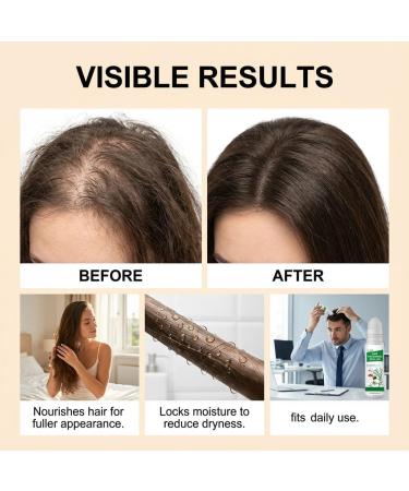 S rum de croissance des cheveux au romarin - Essence pour paissir le cuir chevelu - Soin rafra chissant et non gras du cuir chevelu - Renforce les racines - Soin des cheveux - Soin des cheveux 8 pi ces. - Buy Online on GoSupps.com