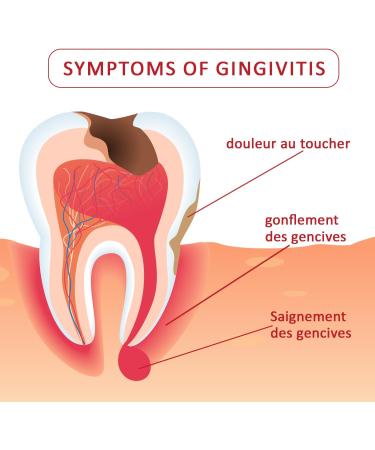 Dentifrice CAREDO pour la gingivite soin r parateur des gencives traitement des gencives saignantes et gonfl es traitement des gencives sensibles traitement de la gingivite pour adultes 100 g - Buy Online on GoSupps.com