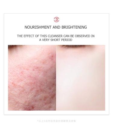 VENZEN Nicotinamide Hydrating Moisturizing Cleanser - Natural Essence Beauty Skin 80g | International Shipping - Buy Online on GoSupps.com