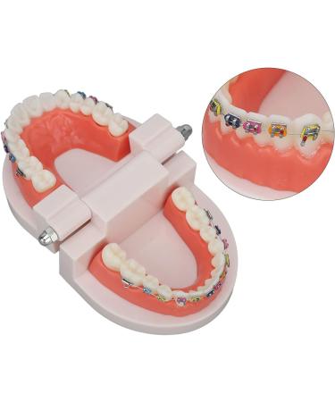 Tooth Demonstration Model - Dental Typodont with Orthodontic Bracket for Dentist Research | International Shipping - Buy Online on GoSupps.com