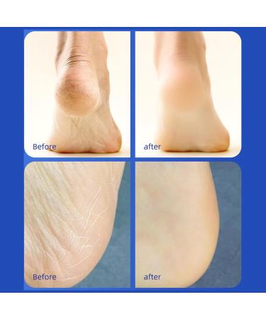 Cracked Foot Balm Cracked Foot Restoration Roll-On Repairing Balm for Dry and Cracked Feet Smoothing and Moisturizing Pw tools - Buy Online on GoSupps.com