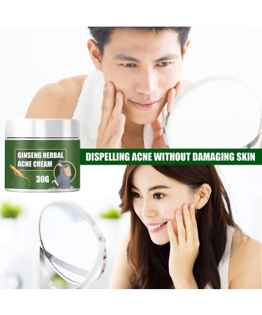 Acne Treatment Cream with 5% Benzoyl Peroxide & Tea Tree Oil - Cystic Acne Spot Treatment for Face - 1.67 oz - Buy Online on GoSupps.com
