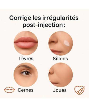  softfil cosmectics SoftFil Topilase - Post-Act Dermo-Adjuster - Corrects Excess Fillers & Imperfections - Soothing Effect - 100% Natural - Rebalances the Skin - Safe Application Without Injection - 2 ml Bottle - Buy Online on GoSupps.com