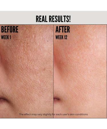 Poria Brightening & pH Balancing Anti-Aging Essence - Remove Dark Spots & Combat Premature Aging for All Skin Types - 3.4 oz - Buy Online on GoSupps.com