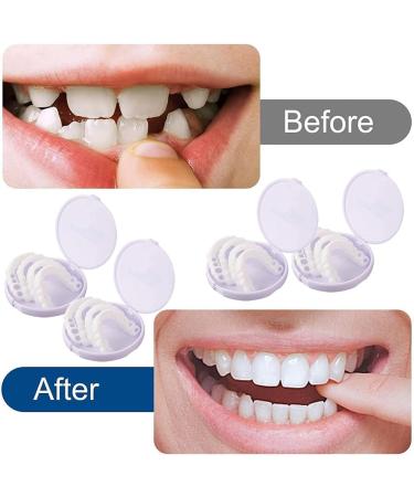 Care Spring 2 Pairs Cosmetic Veneer Teeth Fake Teeth Veneers Top and Bottom Whitening Dentures Natural Tone Instant Smile Veneer Teeth for Man Woman Teeth Whitening and Perfect Smile - Buy Online on GoSupps.com