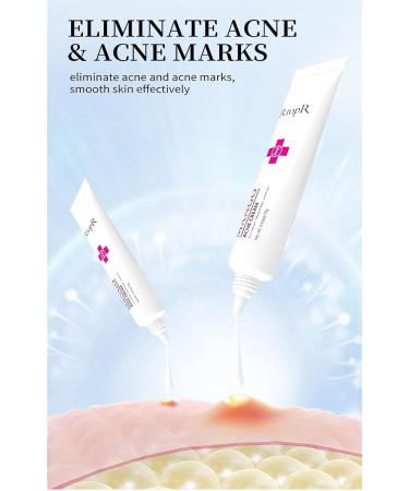 Easilydays Mango Acne Cream: Pimple & Scar Treatment for Moisturized Skin, Pore Reduction & Acne Scar Removal - Balances Water & Oil - Buy Online on GoSupps.com