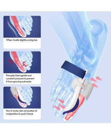 Adjustable Hallux Valgus Corrector - Bunion Toe Splint for Pain Relief - 2 Pcs - Buy Online on GoSupps.com