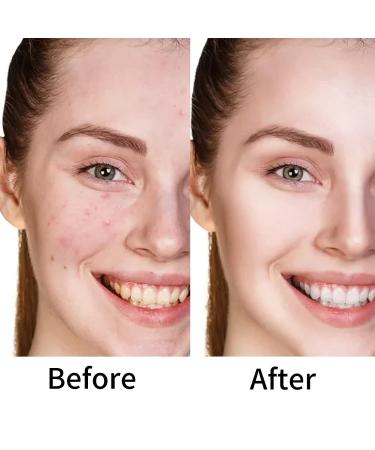 Boobeen Liquid Foundation Concealer - Full Coverage Base for Flawless Skin - Longwear Corrector, Brightener & Contour - Shade 01 - Buy Online on GoSupps.com