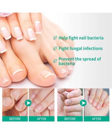 KYOSK Kerassentials Toenail Fungus Treatment Oil Kerassentials for Toenail Fungus Kerasentials Nail Treatment Repair Oil Fix & Renew Damage Nail Broken Cracked & Discolored Nails (6pcs) - Buy Online on GoSupps.com