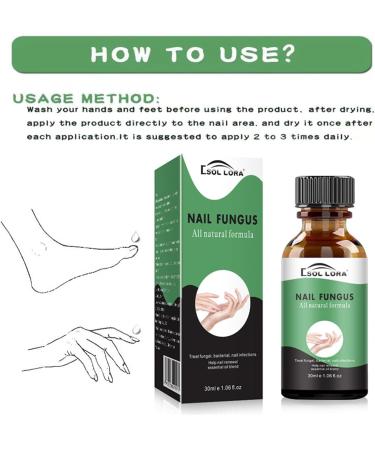 Fungal Nail Treatment - Extra Strong Nail Fungus Treatment for Toenail and Fingernail - Anti fungus Nail Repair and Strengthen Fix & Renew Damaged Broken Nails Restoring Healthy Nails-30ml - Buy Online on GoSupps.com
