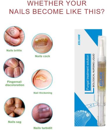Okita Toenail Fungus Treatment Pen - Effective Nail Repair for Healthy and Strong Nails (5Pcs) - Buy Online on GoSupps.com
