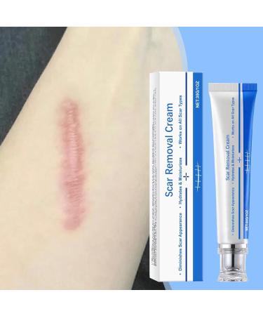 mother Scar ointment after op scar ointment for old scars versatile scar cream for surgical scars caesarean section acne scars burns keloids 30 g - Buy Online on GoSupps.com