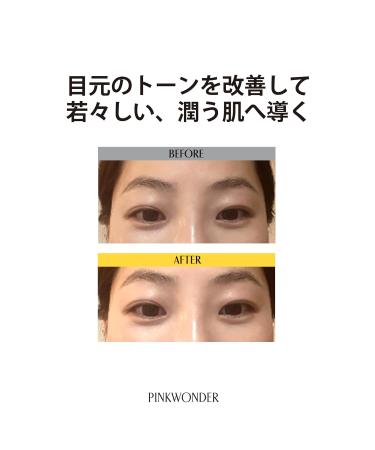 Glow Flow Roseberry Under Eye Care - Hydrating Eye Gel Patches for Dark Circles (3EA) | International Shipping - Buy Online on GoSupps.com