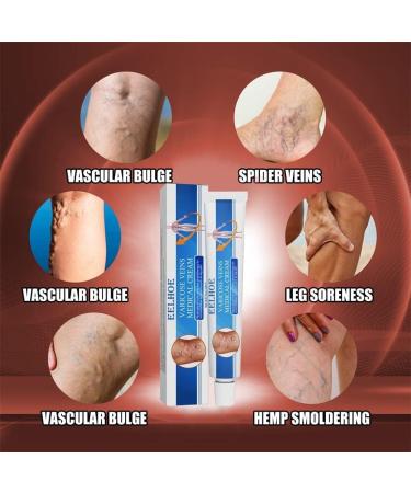 Veinshealth Blue Light Therapy Kit for Varicose Veins with Blue Light Therapy Pen (2 Cream + 1 Pen) - Buy Online on GoSupps.com