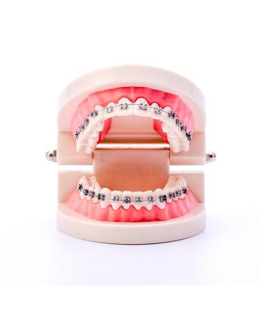 Buy Dental Orthodontic Standard Teeth Model with Metal Brackets & Wires - International Shipping Available - Buy Online on GoSupps.com